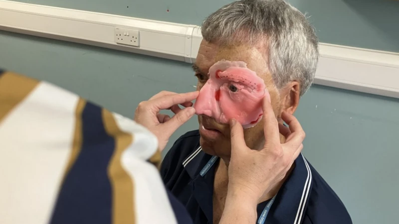 В Великобритании для пострадавшего в аварии велосипедиста напечатали на 3D-принтере часть лица