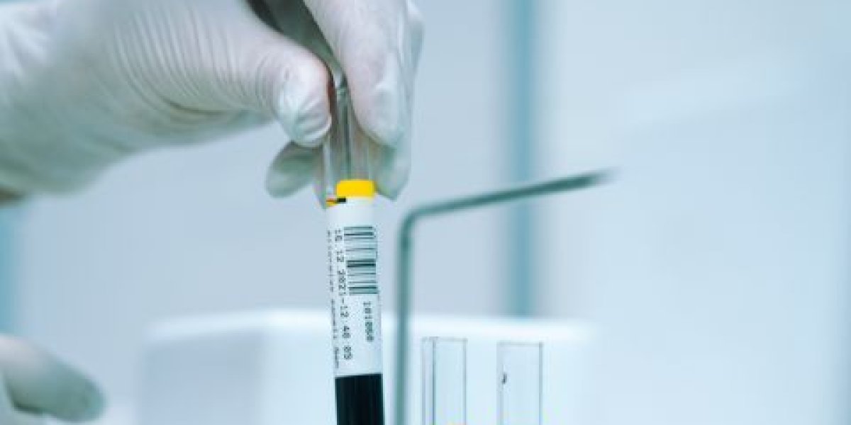 Не только водителям: как изменятся проверки на алкоголь и наркотики с осени