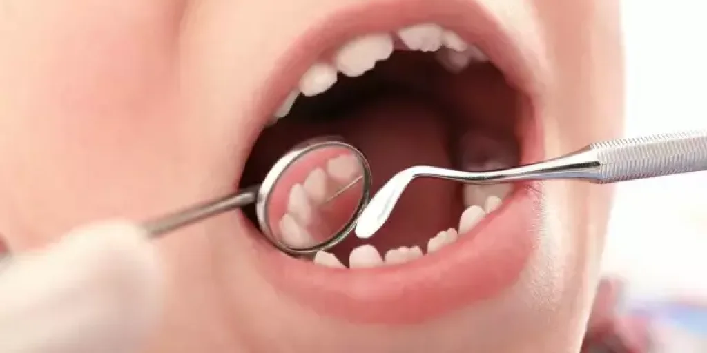 Лечение молочных зубов: основа здоровья детской полости рта