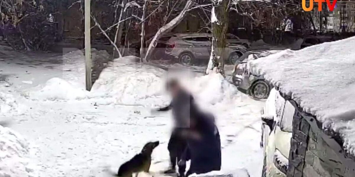 Домашняя собака набросилась на подростка и чуть не растерзала его в Уфе