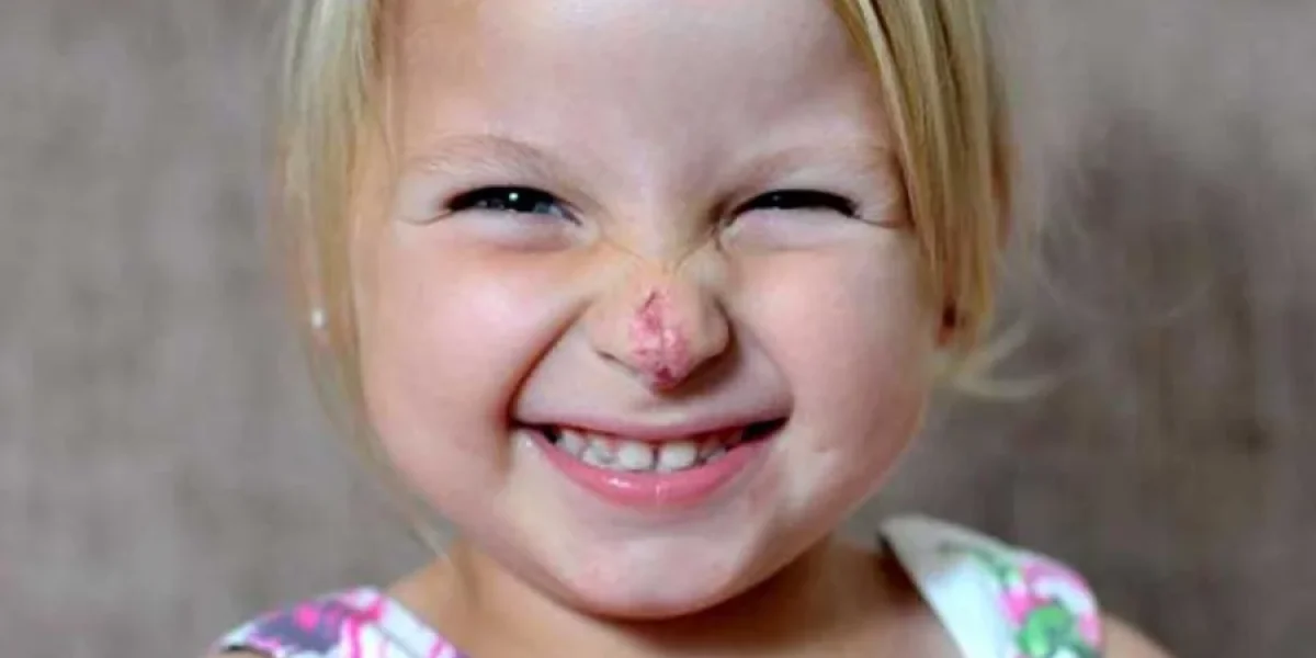 &laquo;Девочка с носом клоуна&raquo;: история Кони Лойд, которая доказала &mdash; испытания не определяют судьбу