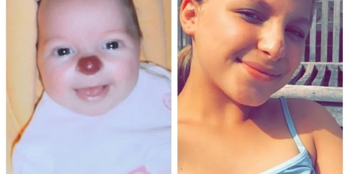 &laquo;Девочка с носом клоуна&raquo;: история Кони Лойд, которая доказала &mdash; испытания не определяют судьбу